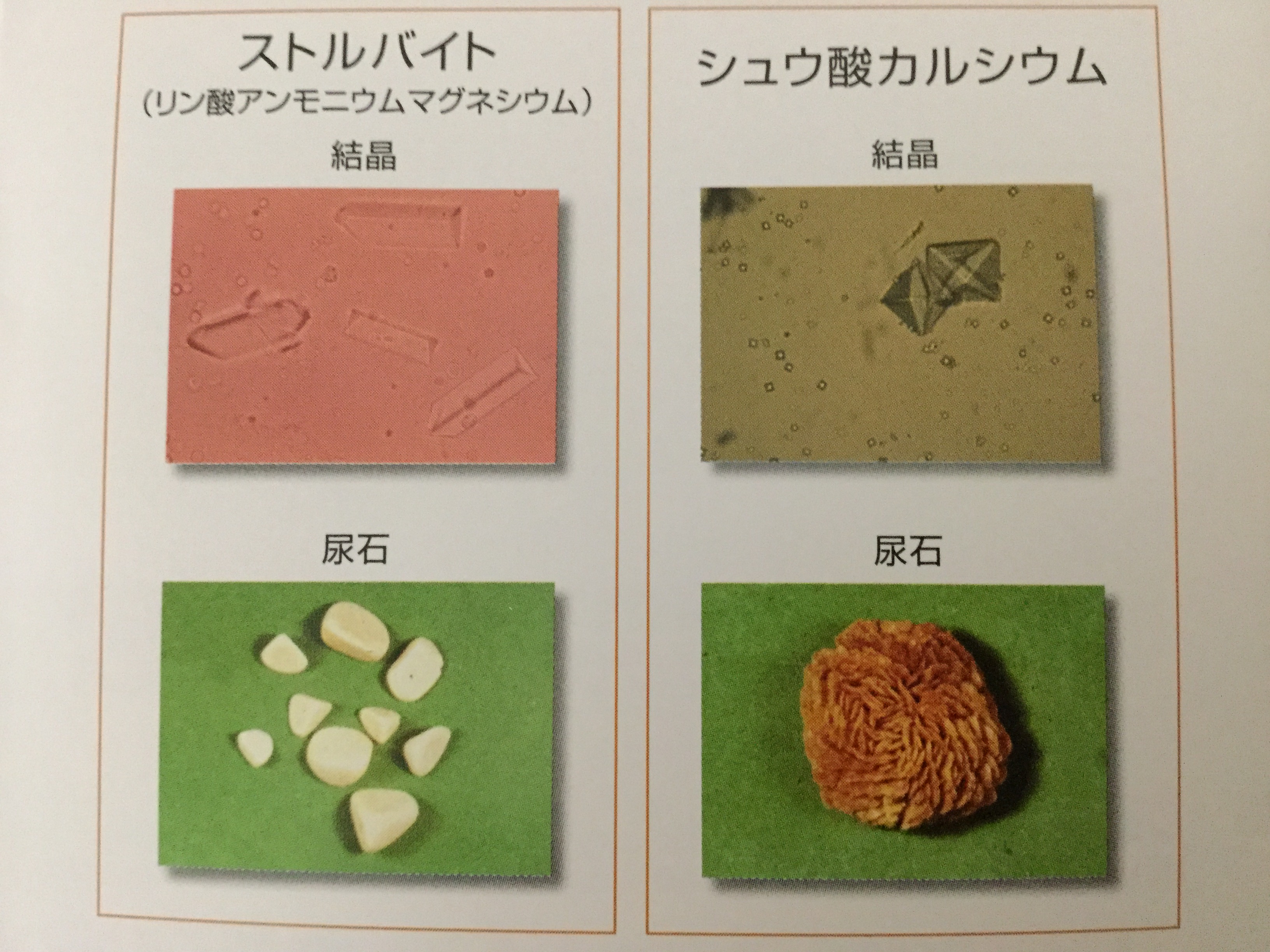 シュウ 酸 カルシウム 結晶 ほうれん草のシュウ酸