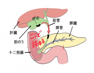 肝外胆管閉塞 3